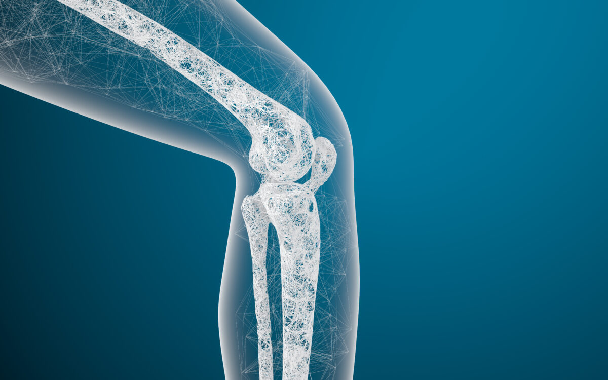 Osteoporosi e osteopenia: come scegliere i cibi giusti