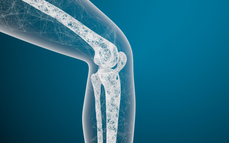 Osteoporosi: l'alimentazione può essere un valido aiuto